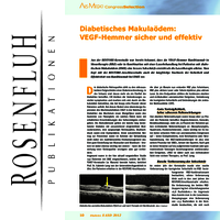 Diabetisches Makulaödem – VEGF-Hemmer sicher und effektiv – Rosenfluh.ch
