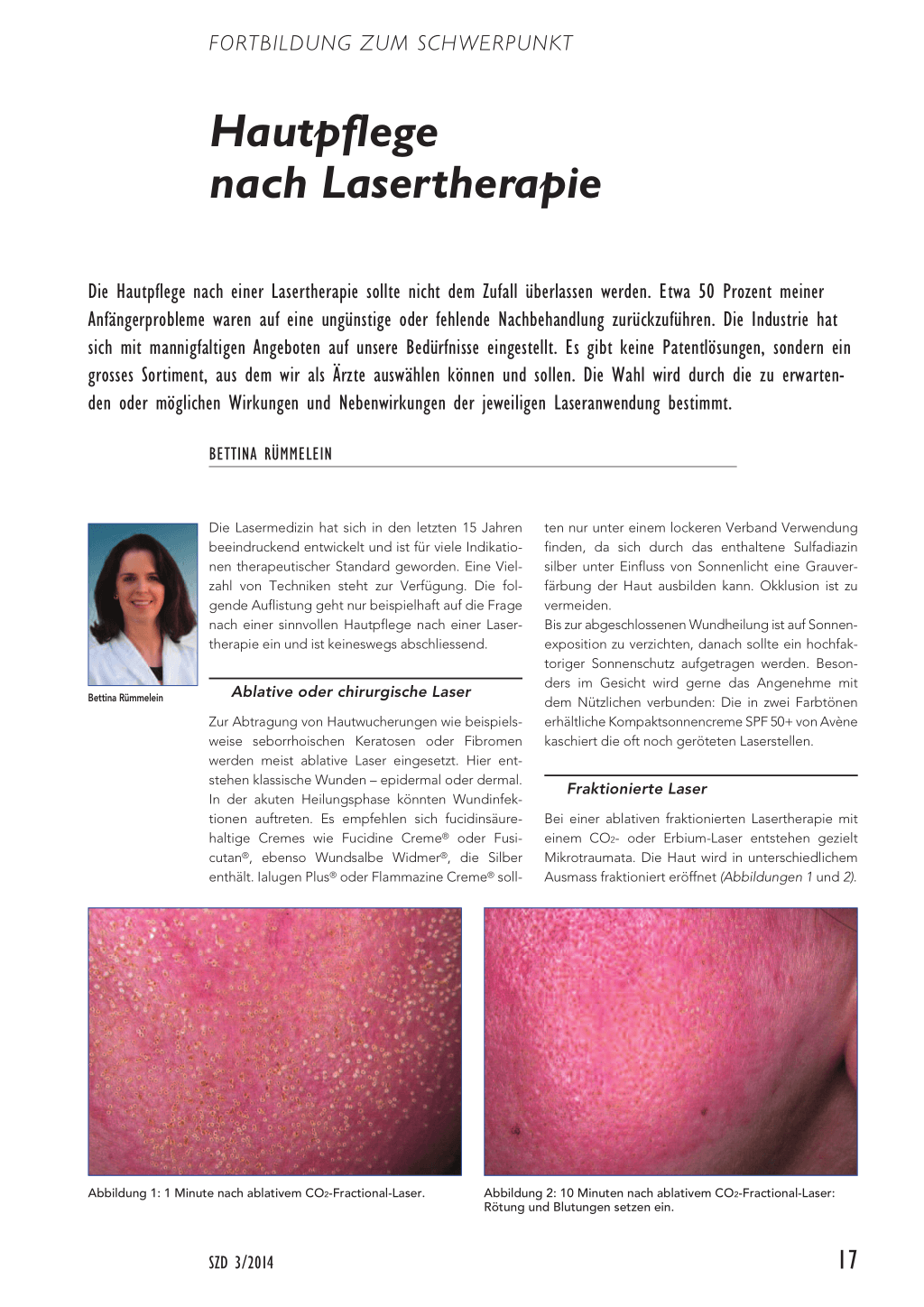 Hautpflege Nach Lasertherapie Rosenfluh Ch