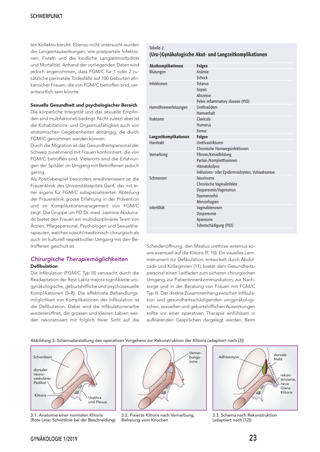 Beschneidung klitoris Category:Female genital